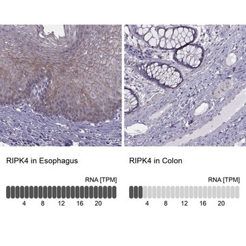 Anti-RIPK4 Prestige Antibodies&#174; Powered by Atlas Antibodies, affinity isolated antibody