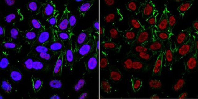 Anti-APE/Ref-1 Antibody, clone 13B8E5C2 clone 13B8E5C2, from mouse