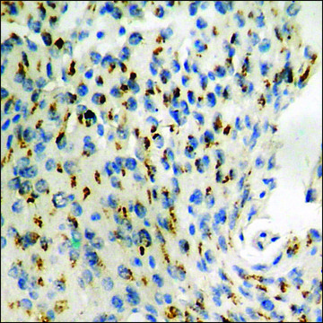 Anti-phospho-CRMP-2 (pThr509) antibody produced in rabbit affinity isolated antibody