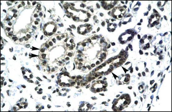 Anti-PTHLH antibody produced in rabbit IgG fraction of antiserum