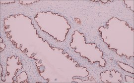 Prostein (EP381) Rabbit Monoclonal Primary Antibody