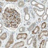 Anti-FGF1 antibody produced in rabbit Prestige Antibodies® Powered by Atlas Antibodies, affinity isolated antibody, buffered aqueous glycerol solution