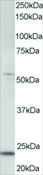 Anti-MAD4/MXD4 antibody produced in goat affinity isolated antibody, buffered aqueous solution