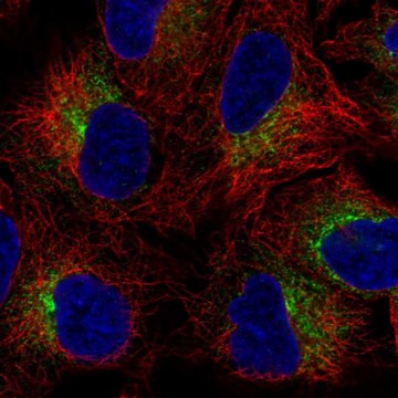 Anti-SLC39A9 antibody produced in rabbit Prestige Antibodies&#174; Powered by Atlas Antibodies, affinity isolated antibody