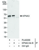 Rabbit anti-KPNA3 Antibody, Affinity Purified Powered by Bethyl Laboratories, Inc.