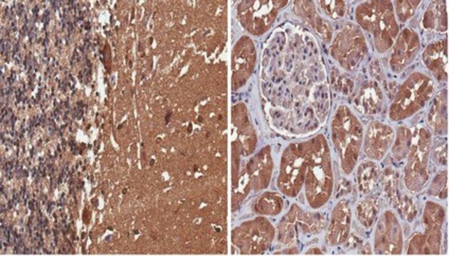 Anti-Tau (4-repeat isoform RD4) Antibody, clone 7D12.1 clone 7D12.1, from mouse