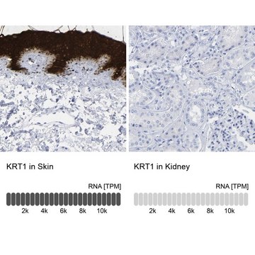 Anti-KRT1 antibody produced in rabbit Prestige Antibodies&#174; Powered by Atlas Antibodies, affinity isolated antibody, buffered aqueous glycerol solution