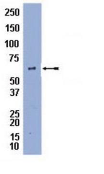 Anti-Perilipin A Antibody Chemicon&#174;, from rabbit