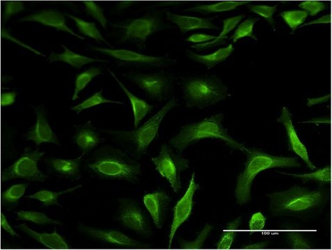 Monoclonal Anti-S100P antibody produced in mouse clone 1A11, purified immunoglobulin, buffered aqueous solution