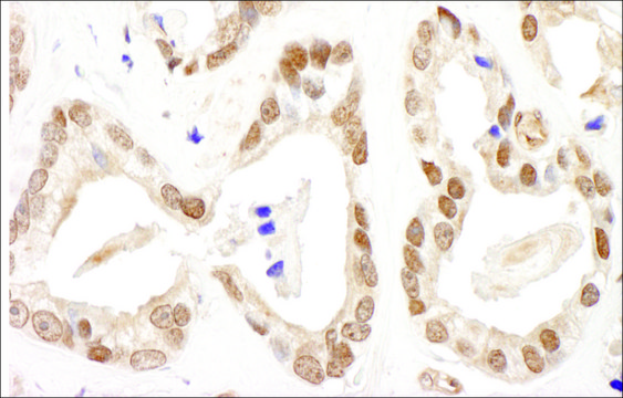 Rabbit anti-FANCD2 Antibody, Affinity Purified Powered by Bethyl Laboratories, Inc.