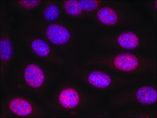 Anti-ESR1 (Ab-118) antibody produced in rabbit affinity isolated antibody