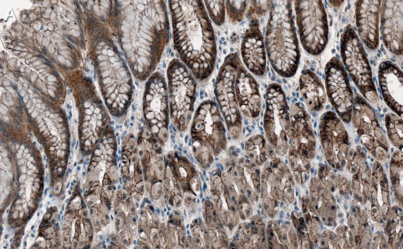 Anti-Cortactin Antibody, clone 1F15 ZooMAb&#174; Rabbit Monoclonal recombinant, expressed in HEK 293 cells