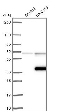 Anti-UNC119 antibody produced in rabbit Prestige Antibodies&#174; Powered by Atlas Antibodies, affinity isolated antibody, buffered aqueous glycerol solution