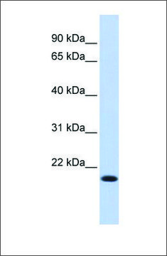 Anti-IRF7 antibody produced in rabbit affinity isolated antibody