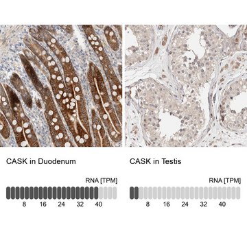 Anti-CASK antibody produced in rabbit Prestige Antibodies&#174; Powered by Atlas Antibodies, affinity isolated antibody, buffered aqueous glycerol solution