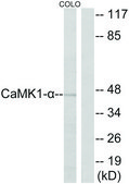 Anti-CAMK1-α antibody produced in rabbit affinity isolated antibody