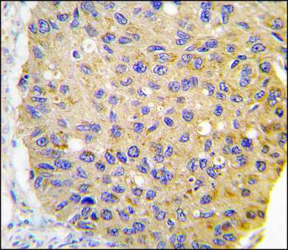 Anti-GHRH (center) antibody produced in rabbit saturated ammonium sulfate (SAS) precipitated, buffered aqueous solution