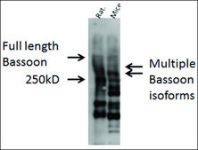 Anti-BSN antibody produced in rabbit 1 mg/mL, affinity isolated antibody