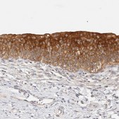 Anti-SH3GLB2 antibody produced in rabbit Prestige Antibodies® Powered by Atlas Antibodies, affinity isolated antibody, buffered aqueous glycerol solution, Ab2