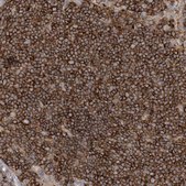 Anti-IL1RAPL2 antibody produced in rabbit Prestige Antibodies® Powered by Atlas Antibodies, affinity isolated antibody, buffered aqueous glycerol solution