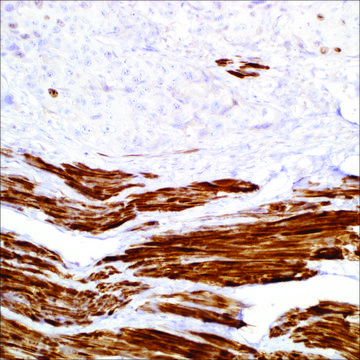 Smoothelin (R4A) Mouse Monoclonal Antibody