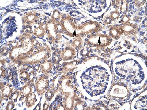 Anti-CDC2 (C-terminal) antibody produced in rabbit affinity isolated antibody