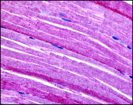 Anti-GRK5 antibody produced in rabbit affinity isolated antibody, buffered aqueous solution