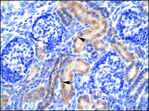 Anti-PCK1 (AB2) antibody produced in rabbit affinity isolated antibody