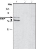Anti-PINK1 (N-terminal region) antibody produced in rabbit ~1.5 mg/mL, affinity isolated antibody, buffered aqueous solution