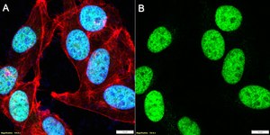 Anti-Histone Macro H2A.1 Antibody, clone 1M7 ZooMAb® Rabbit Monoclonal recombinant, expressed in HEK 293 cells