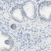 Anti-JPH1 antibody produced in rabbit Prestige Antibodies® Powered by Atlas Antibodies, affinity isolated antibody, buffered aqueous glycerol solution