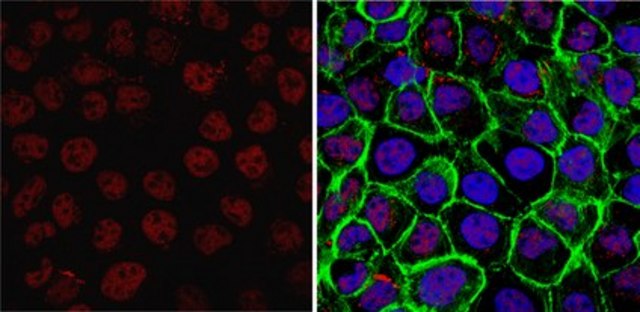 Anti-TAF10/TAFII30 Antibody, clone 6TA-2B11 ascites fluid, clone 6TA-2B11, from mouse