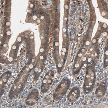 Anti-SDSL antibody produced in rabbit Prestige Antibodies&#174; Powered by Atlas Antibodies, affinity isolated antibody, buffered aqueous glycerol solution