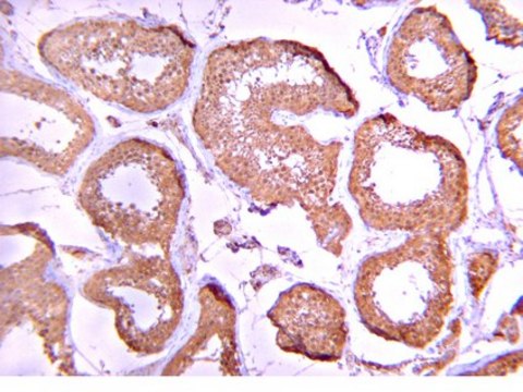 Anti-Protein Phosphatase 2 C &#945;/&#946; Antibody from rabbit