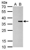 Monoclonal Anti-COL11A2 antibody produced in mouse clone GT473, affinity isolated antibody