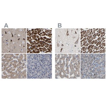 Anti-UQCRC2 antibody produced in rabbit Prestige Antibodies&#174; Powered by Atlas Antibodies, affinity isolated antibody, buffered aqueous glycerol solution