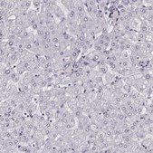 Anti-TMPRSS15 Prestige Antibodies® Powered by Atlas Antibodies, affinity isolated antibody