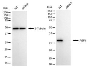 KD-Validated Anti PEF1 Antibody Antibody, clone 24GB1340, Rabbit Monoclonal clone 24GB1340, recombinant rabbit monoclonal, expressed in HEK293 cells