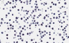 Anti-LBPA Antibody, clone 6C4 ZooMAb® Mouse Monoclonal recombinant, expressed in HEK 293 cells