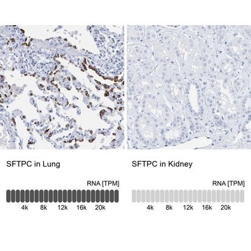 抗-SFTPC 兔抗 Prestige Antibodies&#174; Powered by Atlas Antibodies, affinity isolated antibody, buffered aqueous glycerol solution, Ab1