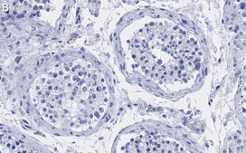 Anti-UBR5 Antibody, clone 2F14 ZooMAb® Rabbit Monoclonal recombinant, expressed in HEK 293 cells