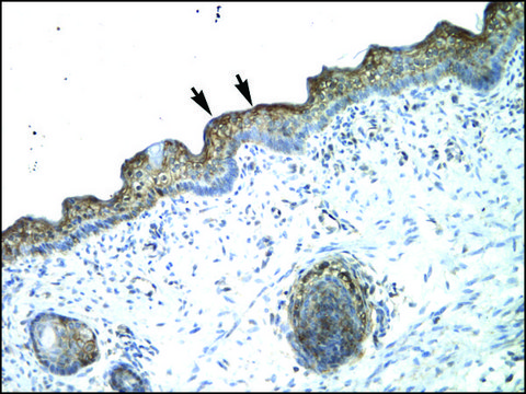 Anti-MYBL2 affinity isolated antibody