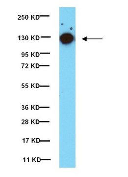 Anti-phospho-Focal Adhesion Kinase (Tyr397) Antibody, clone 18 clone 18, from mouse