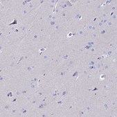 Anti-RNASE2 antibody produced in rabbit Prestige Antibodies® Powered by Atlas Antibodies, affinity isolated antibody, buffered aqueous glycerol solution