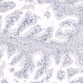 Monoclonal Anti-INHBA antibody produced in mouse Prestige Antibodies® Powered by Atlas Antibodies, clone CL15357, purified antibody (Protein A)