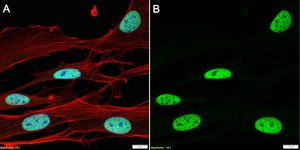 Anti-CHD4 Antibody, clone 1C17 ZooMAb® Rabbit Monoclonal recombinant, expressed in HEK 293 cells