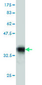 Monoclonal Anti-PTGIR antibody produced in mouse clone 4B10, purified immunoglobulin, buffered aqueous solution