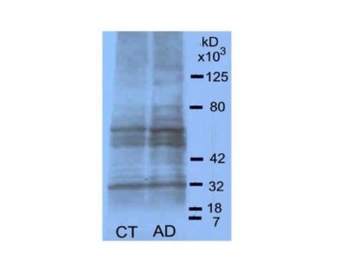 Anti-AGE (Advanced Glycation End-products) Antibody serum, Chemicon&#174;