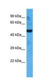 Anti-ACVR2B antibody produced in rabbit affinity isolated antibody