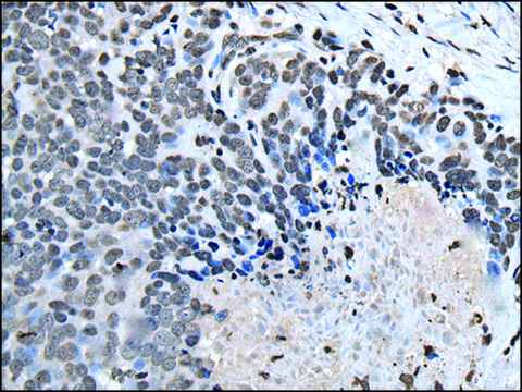 Anti-HOXD1 affinity isolated antibody